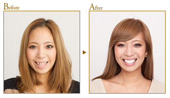 美容歯科 美容歯科