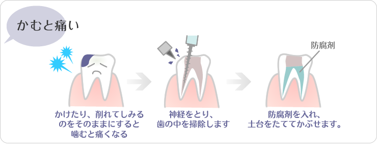 歯 痛い