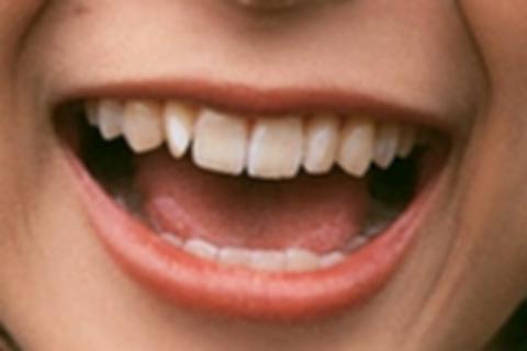 歯 歯